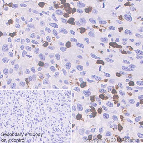 Immunohistochemistry (Formalin/PFA-fixed paraffin-embedded sections) - Anti-IL-26 antibody [EPR22268-141] - BSA and Azide free (AB254476)
