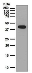 Western blot - Anti-IL-26 antibody [EPR6745] (AB133659)
