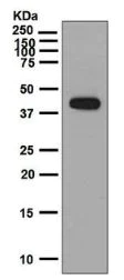 Anti-IL-26 antibody [EPR6745] (ab133659) | Abcam