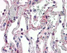 Immunohistochemistry (Formalin/PFA-fixed paraffin-embedded sections) - Anti-IL-27-A antibody (AB115671)
