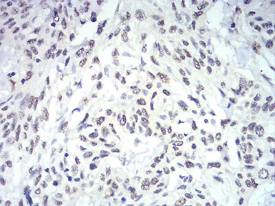 Immunohistochemistry (Formalin/PFA-fixed paraffin-embedded sections) - Anti-IL-28A antibody [7B9A4] (AB233761)