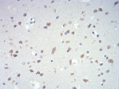 Immunohistochemistry (Formalin/PFA-fixed paraffin-embedded sections) - Anti-IL-28A antibody [7B9A4] (AB233761)