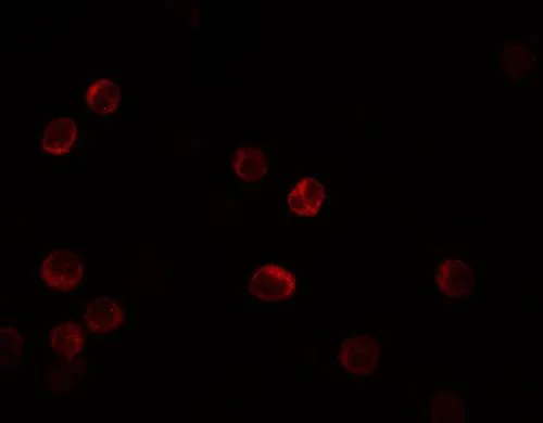 Immunocytochemistry/ Immunofluorescence - Anti-IL-28B antibody (AB181411)