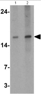 Western blot - Anti-IL-28B antibody (AB181411)