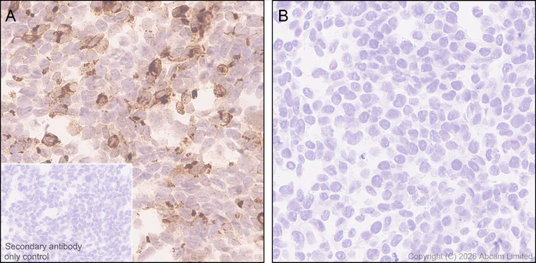 Immunohistochemistry (Formalin/PFA-fixed paraffin-embedded sections) - Anti-IL-29 antibody [EPR19773-96] - BSA and Azide free (Capture) (AB244788)