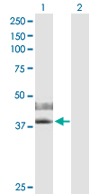 Western blot - Anti-IL-2RG antibody (AB172034)