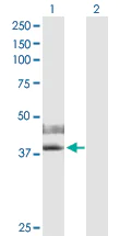 Western blot - Anti-IL-2RG antibody (AB172034)