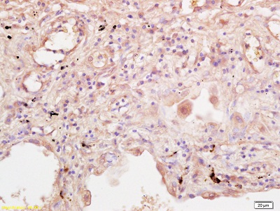 Immunohistochemistry (Formalin/PFA-fixed paraffin-embedded sections) - Anti-IL-2RG antibody (AB202911)