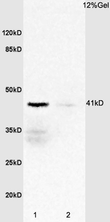 Western blot - Anti-IL-2RG antibody (AB202911)