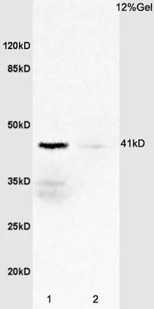 Western blot - Anti-IL-2RG antibody (AB202911)