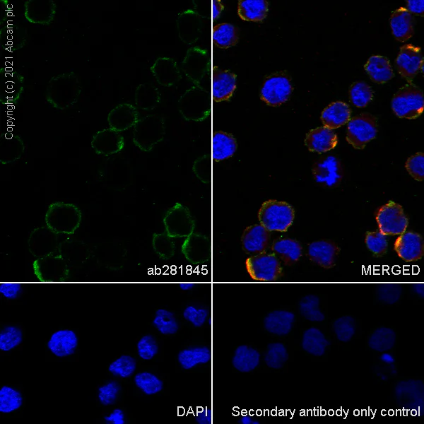 Immunocytochemistry/ Immunofluorescence - Anti-IL-2RG antibody [EPR24561-27] - BSA and Azide free (AB281850)