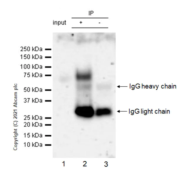 Immunoprecipitation - Anti-IL-2RG antibody [EPR24561-27] - BSA and Azide free (AB281850)