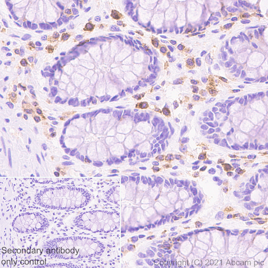 Immunohistochemistry (Formalin/PFA-fixed paraffin-embedded sections) - Anti-IL-2RG antibody [EPR24694-133] (AB273023)