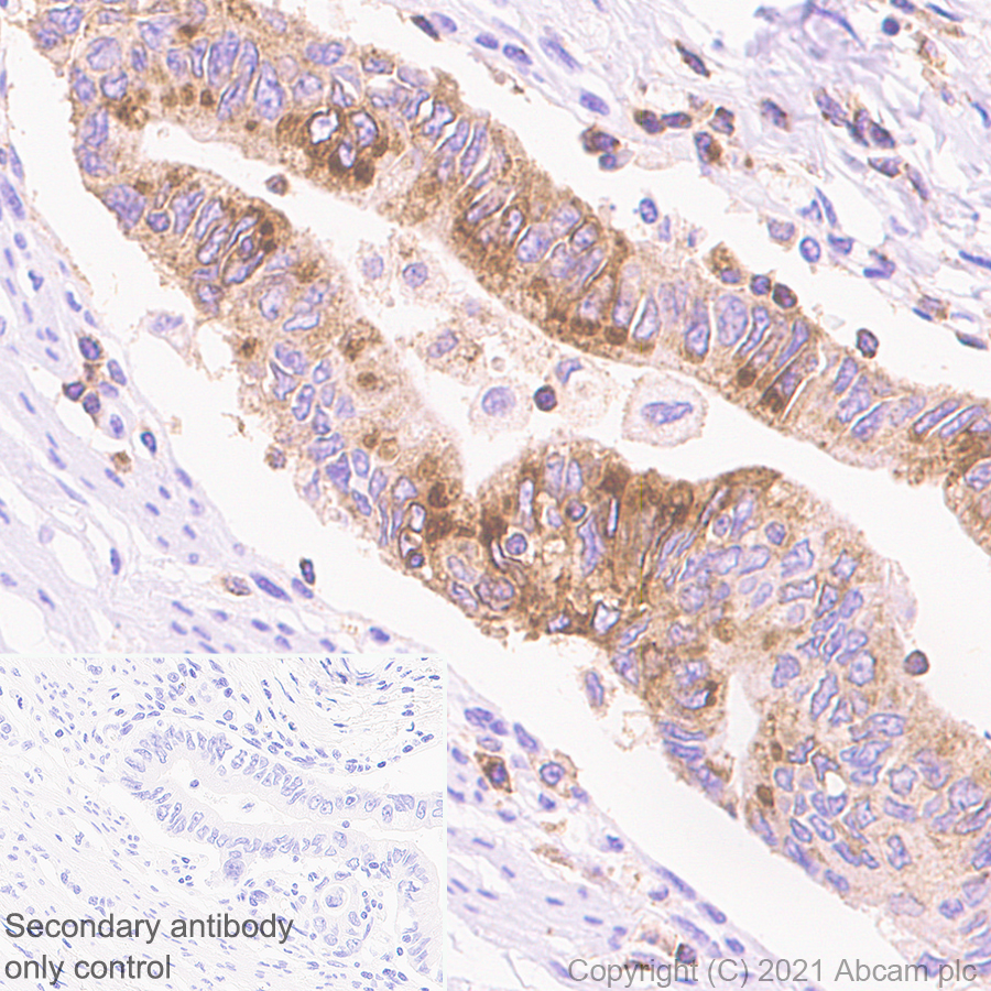 Immunohistochemistry (Formalin/PFA-fixed paraffin-embedded sections) - Anti-IL-2RG antibody [EPR24694-133] (AB273023)