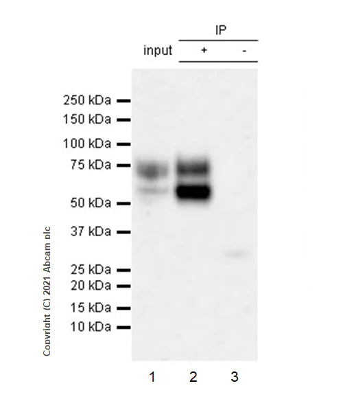 Immunoprecipitation - Anti-IL-2RG antibody [EPR24694-133] (AB273023)