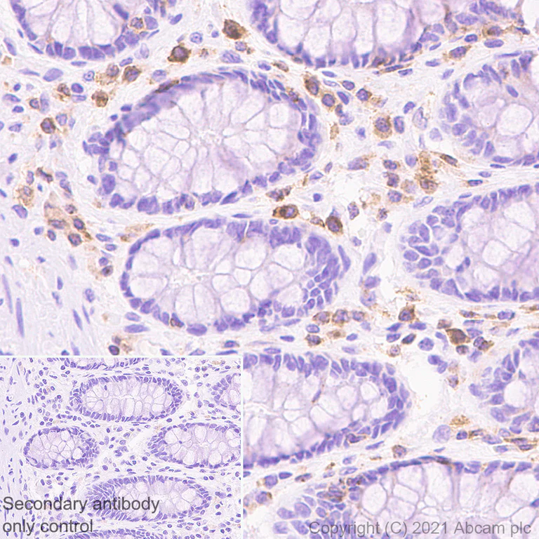 Immunohistochemistry (Formalin/PFA-fixed paraffin-embedded sections) - Anti-IL-2RG antibody [EPR24694-133] - BSA and Azide free (AB282585)