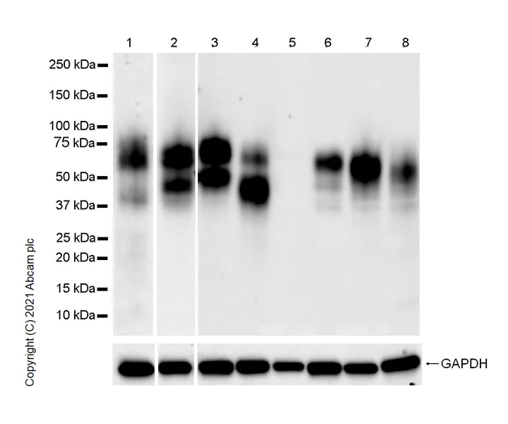 Western blot - Anti-IL-2RG antibody [EPR24694-133] - BSA and Azide free (AB282585)