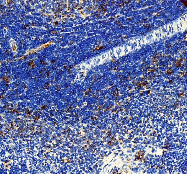 Immunohistochemistry (Formalin/PFA-fixed paraffin-embedded sections) - Anti-IL-3 antibody (AB190941)