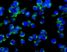 Immunocytochemistry/ Immunofluorescence - Anti-IL-3 antibody [EPR7964] (AB167159), expandable thumbnail
