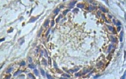 Immunohistochemistry (Formalin/PFA-fixed paraffin-embedded sections) - Anti-IL-31RA antibody (AB113498)