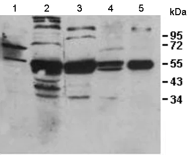 Western blot - Anti-IL-31RA antibody (AB113498)