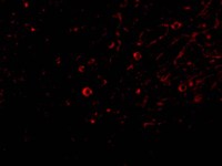 Immunocytochemistry/ Immunofluorescence - Anti-IL-32 antibody (AB37158)