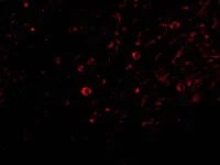 Immunocytochemistry/ Immunofluorescence - Anti-IL-32 antibody (AB37158)