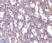 Immunohistochemistry (Formalin/PFA-fixed paraffin-embedded sections) - Anti-IL-32 antibody (AB37158)