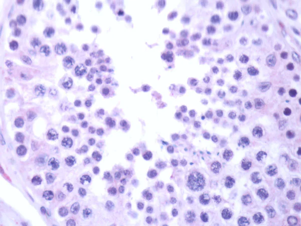 Immunohistochemistry (Formalin/PFA-fixed paraffin-embedded sections) - Anti-IL-33 antibody (AB118503)