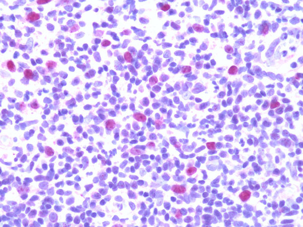 Immunohistochemistry (Formalin/PFA-fixed paraffin-embedded sections) - Anti-IL-33 antibody (AB118503)