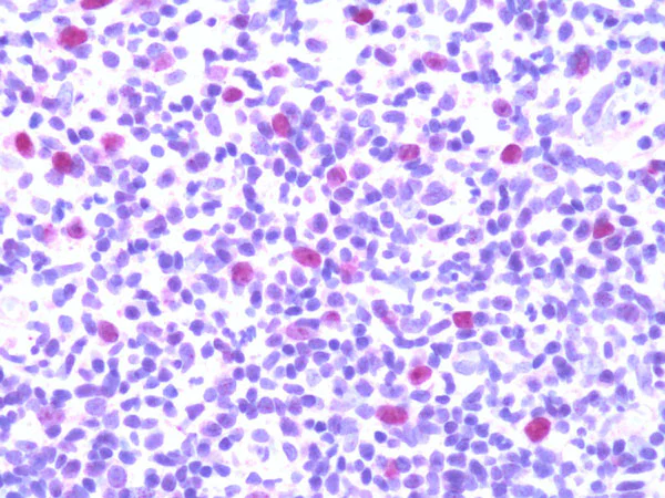 Immunohistochemistry (Formalin/PFA-fixed paraffin-embedded sections) - Anti-IL-33 antibody (AB118503)