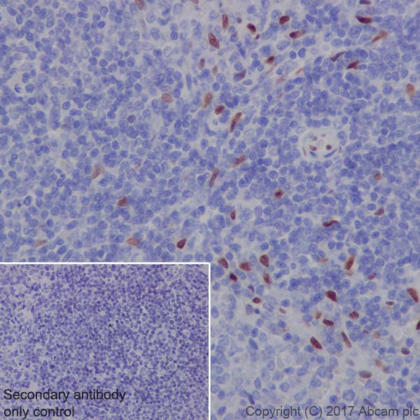 Immunohistochemistry (Formalin/PFA-fixed paraffin-embedded sections) - Anti-IL-33 antibody [EPR17831] (AB187060), expandable thumbnail