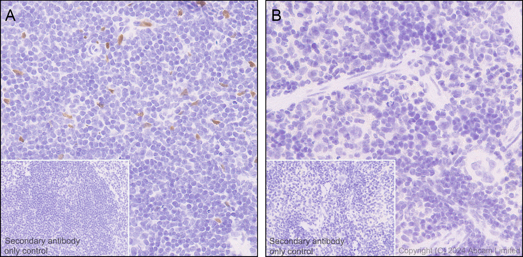 Immunohistochemistry (Formalin/PFA-fixed paraffin-embedded sections) - Anti-IL-33 antibody [EPR17831] (ab187060), expandable thumbnail