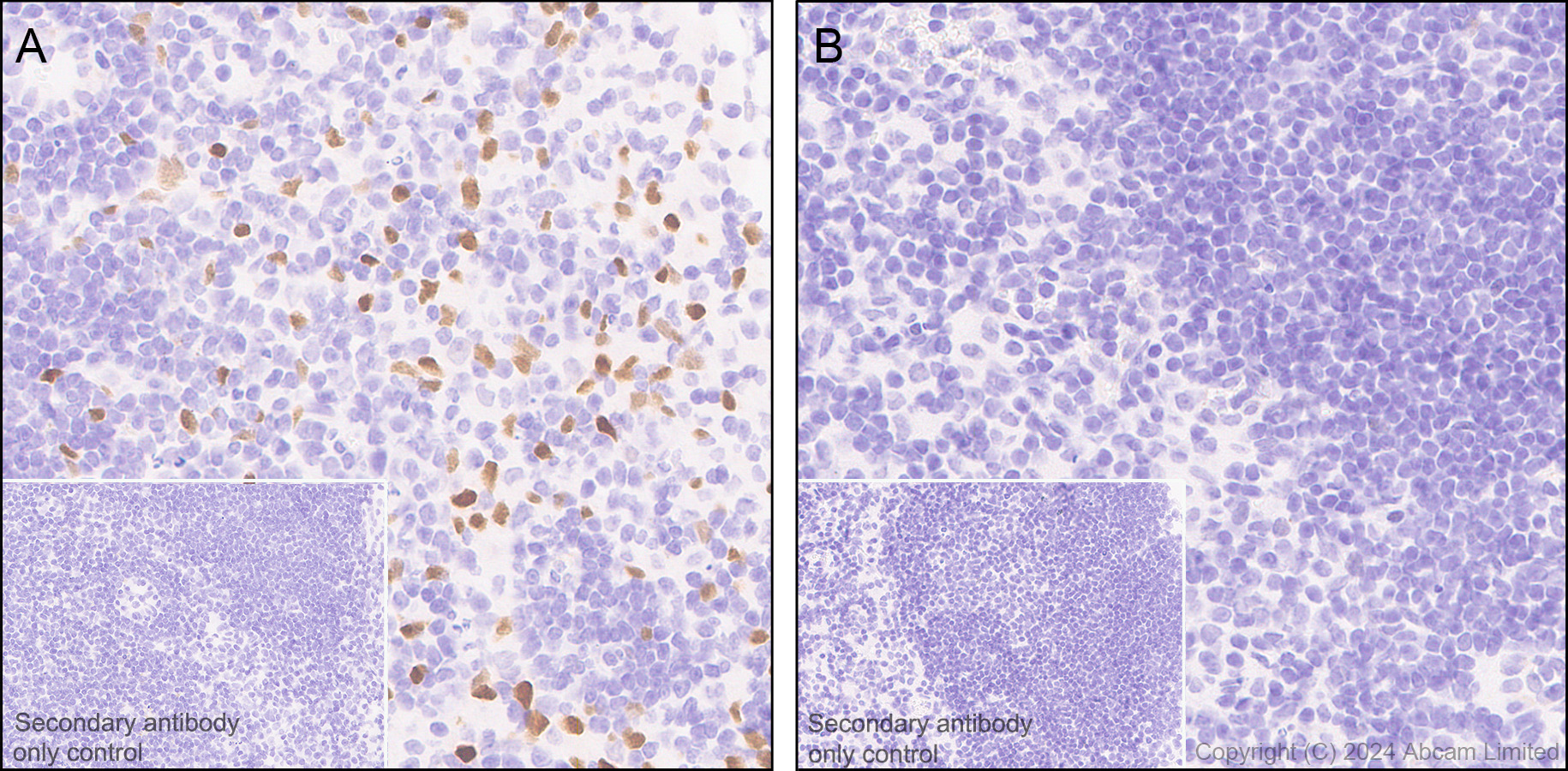 Immunohistochemistry (Formalin/PFA-fixed paraffin-embedded sections) - Anti-IL-33 antibody [EPR17831] (ab187060), expandable thumbnail