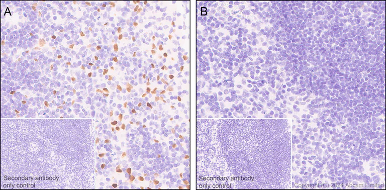 Immunohistochemistry (Formalin/PFA-fixed paraffin-embedded sections) - Anti-IL-33 antibody [EPR17831] (AB187060)