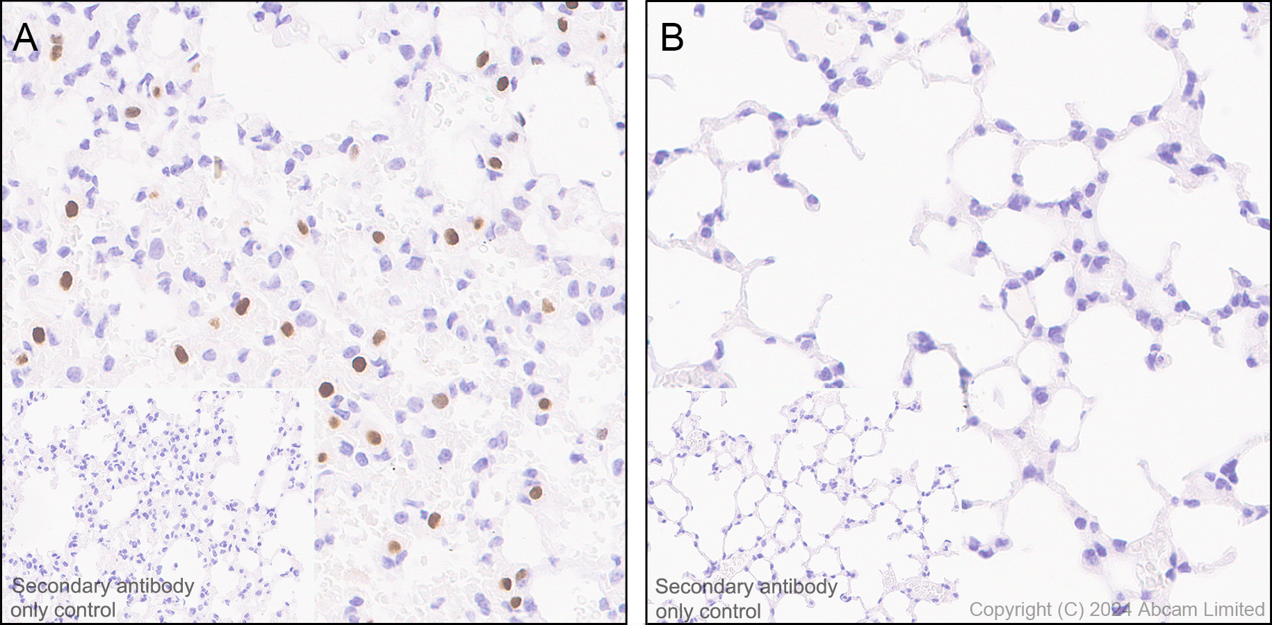 Immunohistochemistry (Formalin/PFA-fixed paraffin-embedded sections) - Anti-IL-33 antibody [EPR17831] (ab187060), expandable thumbnail