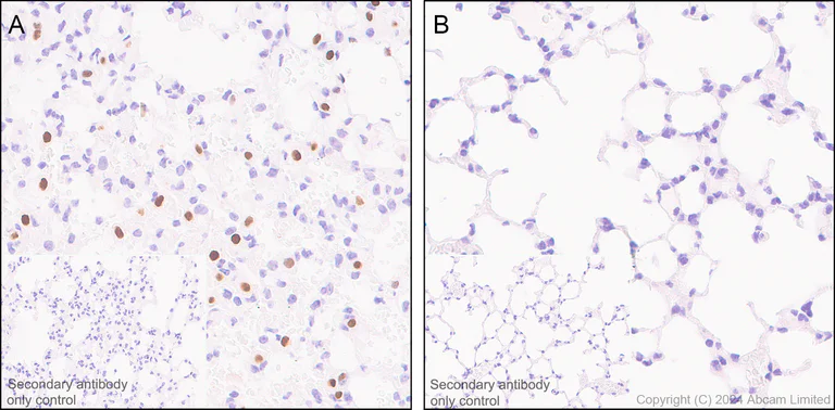 Immunohistochemistry (Formalin/PFA-fixed paraffin-embedded sections) - Anti-IL-33 antibody [EPR17831] (AB187060)