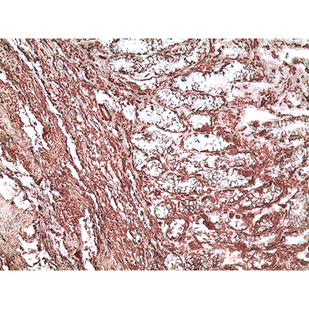 Immunohistochemistry (Formalin/PFA-fixed paraffin-embedded sections) - Anti-IL-33 antibody [Nessy-1] - BSA and Azide free (AB54385)