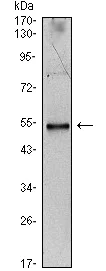 Western blot - Anti-IL-34 antibody [1D12] (AB101443)