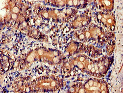 Immunohistochemistry (Formalin/PFA-fixed paraffin-embedded sections) - Anti-IL-34 antibody (AB224734)