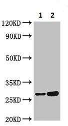 Western blot - Anti-IL-34 antibody (AB224734)