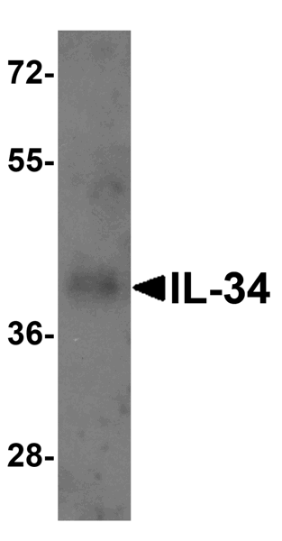 Western blot - Anti-IL-34 antibody (AB74548)