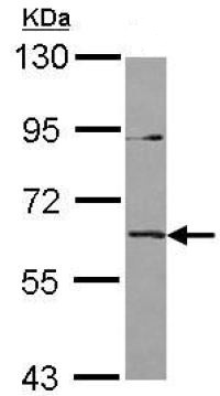 Western blot - Anti-IL-36R antibody (AB126999)