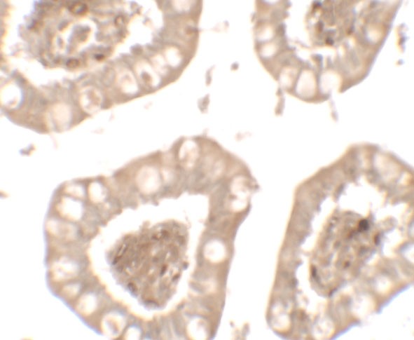 Immunohistochemistry (Formalin/PFA-fixed paraffin-embedded sections) - Anti-IL-36R antibody (AB180894), expandable thumbnail