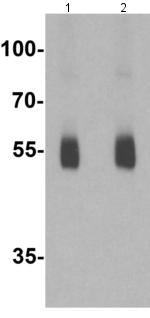 Western blot - Anti-IL-36R antibody (AB180894), expandable thumbnail