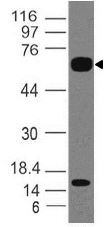 Western blot - Anti-IL-36R antibody [ABM47A2] - N-terminal (AB210933)