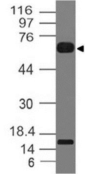 Western blot - Anti-IL-36R antibody [ABM4B73] - N-terminal (AB210926)