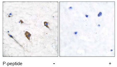Immunohistochemistry (Formalin/PFA-fixed paraffin-embedded sections) - Anti-IL-3RB (phospho Y593) antibody (AB53695), expandable thumbnail