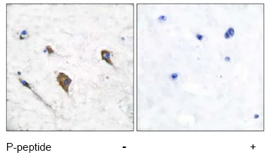 Immunohistochemistry (Formalin/PFA-fixed paraffin-embedded sections) - Anti-IL-3RB (phospho Y593) antibody (AB53695)