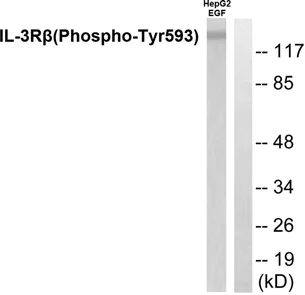 Western blot - Anti-IL-3RB (phospho Y593) antibody (AB53695)